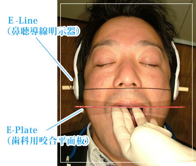 E-Line(鼻聴導線明示器)