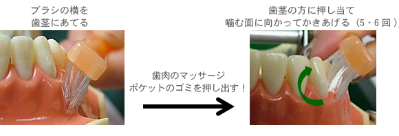 MTB歯ブラシの基本的な磨き方